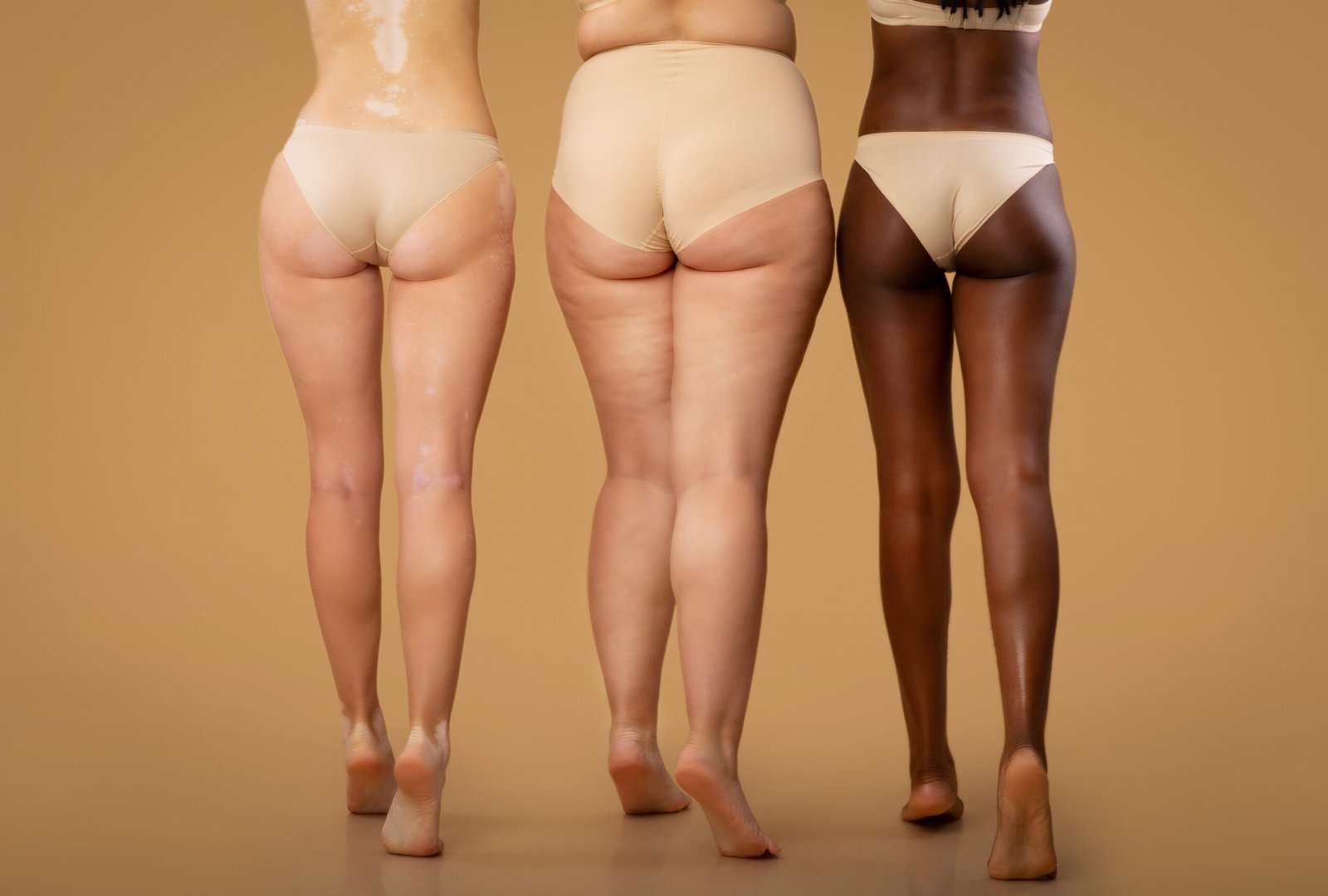 Rear View Of Three Women With Different Body Types In Underwear, Legs Of Multi-Ethnic Ladies With Diverse Skin Conditions Standing In Lingerie On Beige Studio Background, Cropped Image With Free Space
